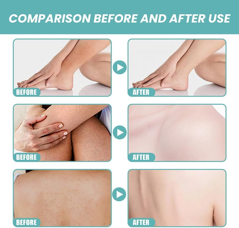 Skin so Soft Original Bath Oil,Skin Bath Oil so Soft Original Lotion,Skin Moisturizing Smoothing & Softens Dry or Rough Skin,Soft Skin Original Bath Oil for Women image number 1