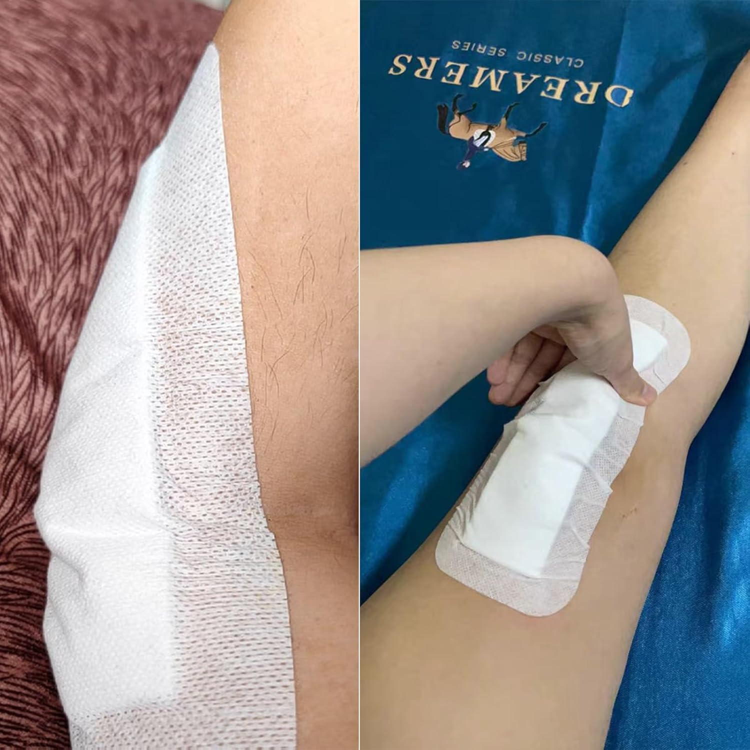 Wound Dressings Adhesive, Large Dressing Pads Padding with Absorbent Patch, Individually Wrapped(10 X 25Cm, 10 Pack) image number 1