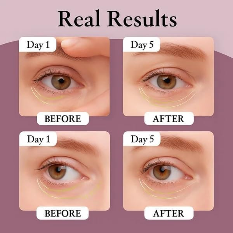 Snake Venom Freeze-Dried Tablets, Eye Pattern Management Set image number 3