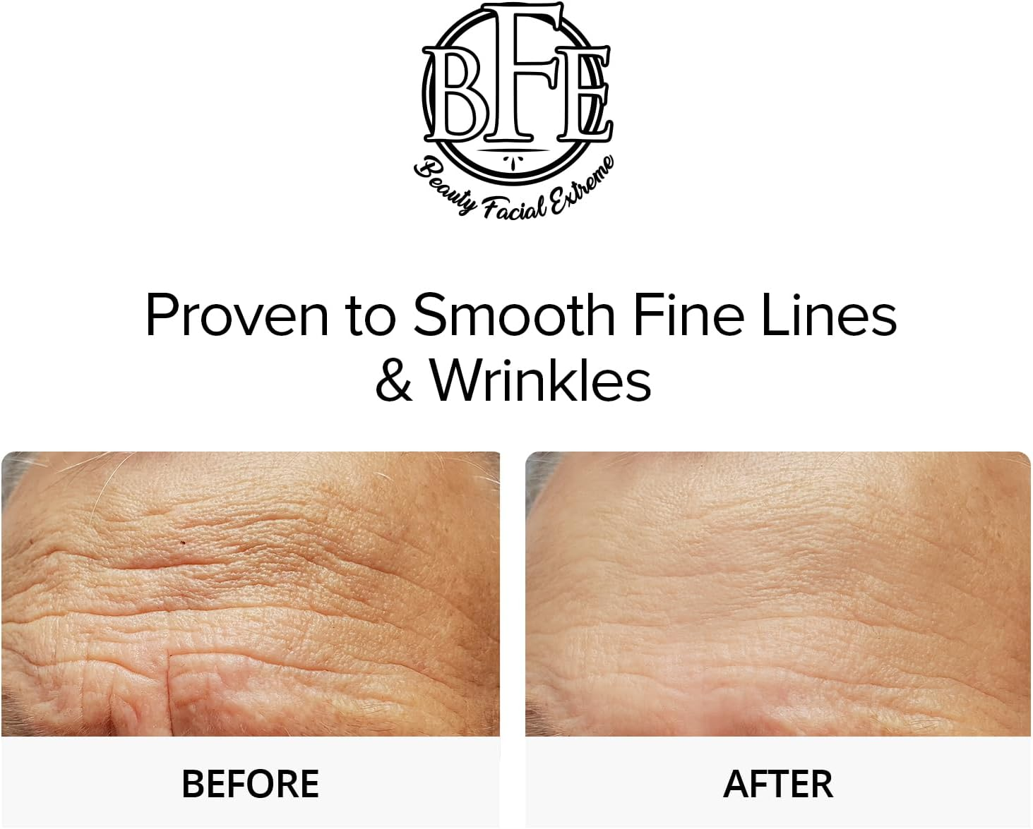 Glycolic Acid 15% Anti-Wrinkle Cream- Extra Strength Alpha Hydroxy Acid Enhanced with Green Tea Extract. Improves Complexion & Smooths Out Fine Lines & Wrinkles. image number 4