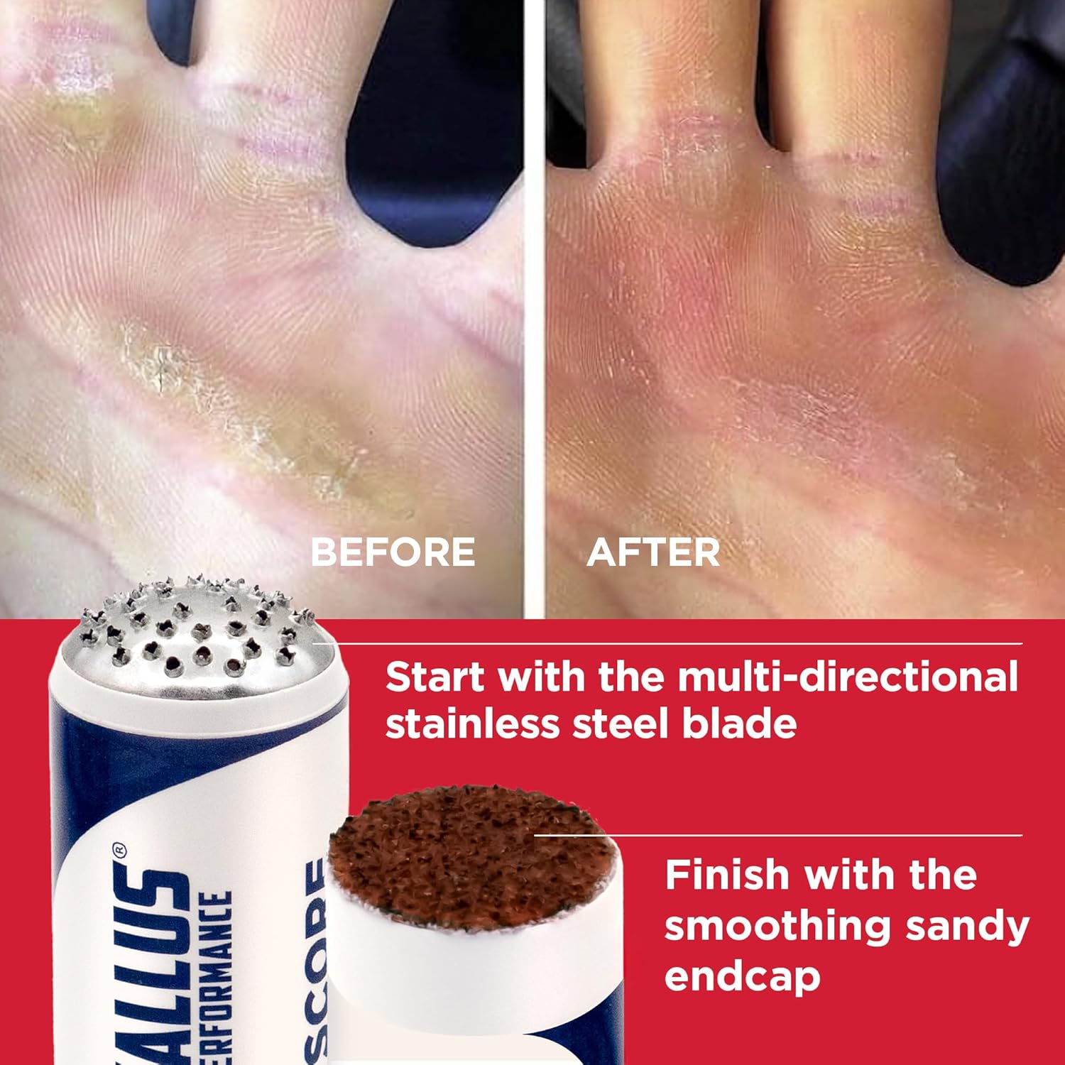 Callus Performance - the Ultimate Callus Remover for Crossfit Athletes and High Friction Hand Use. L Remove Unwanted Calluses I Prevents Ripping and Tearing of Hands I image number 2