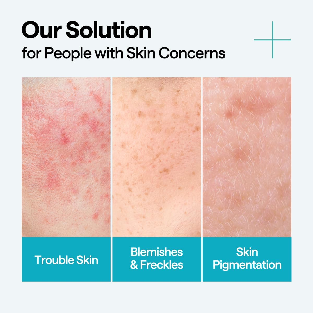 MEDIHEAL Madecassoside Repair Serum 1.35 Fl.Oz - Blemish Care, Fades Pigmentation and Freckles & Skin Soothing & Hydration - with Centella Asiatica, Niacinamide image number 5