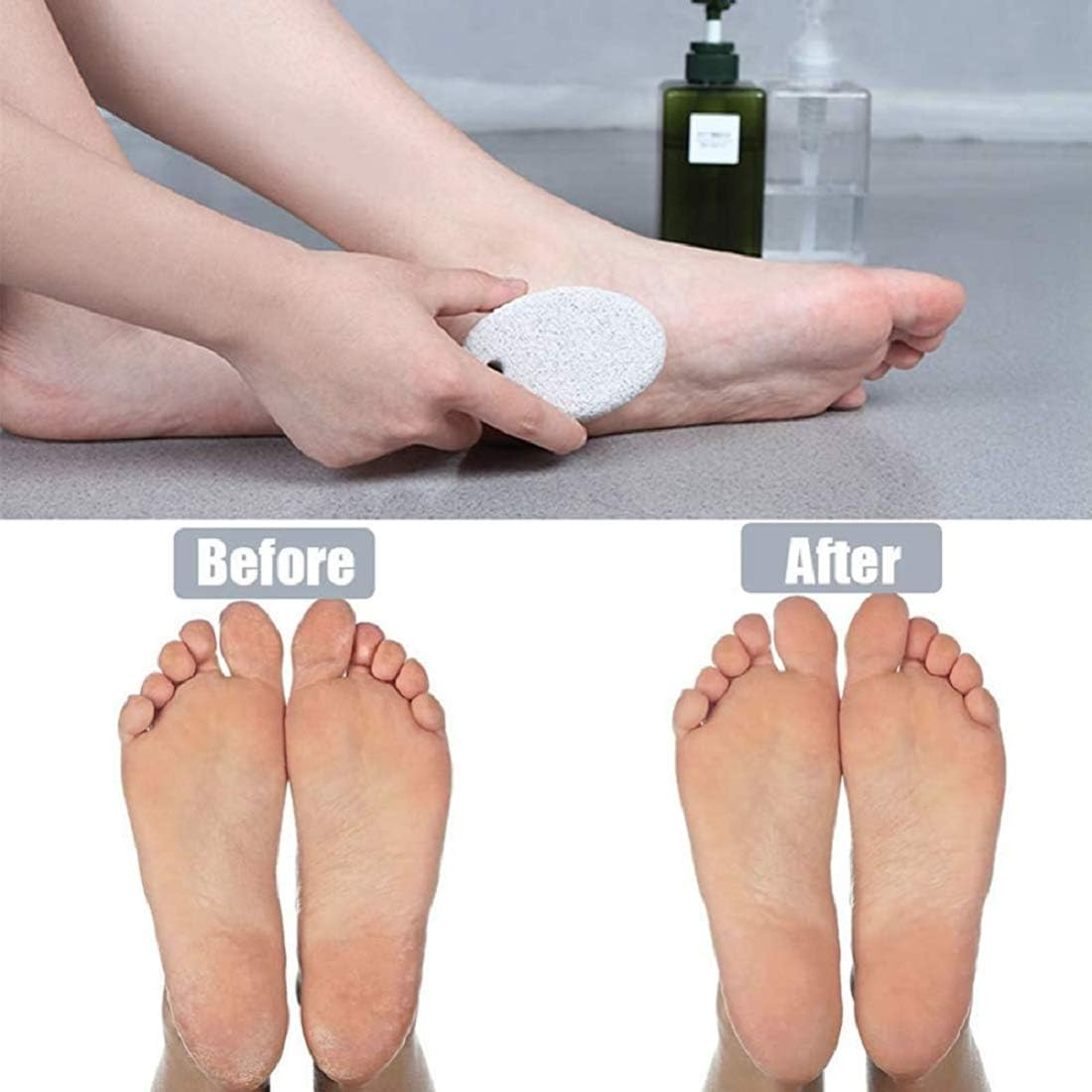 Myynti Foot Scrubber Stone for Dead Skin Remover for Dry Dead Skin, Heels, Elbows, Hand Foot Care (Pack of 1) image number 3