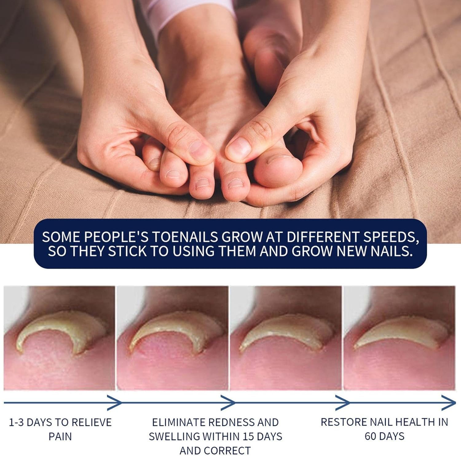 Ingrown Toenail Corrector | Professional Ingrown Toenail Drops Liquid Relief Oil,10Ml Ingrown Toenail Reliever and Softener for Easy Trimming, Toenail Pedicure image number 3