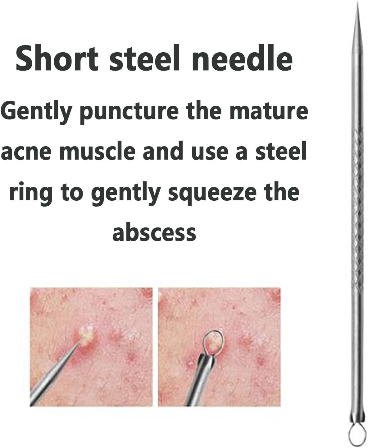 SYGELER Professional Stainless Steel Blackhead Remover Tool - Acne/Pimple Extractor Kit, Painless Blemish Removal for Face, Nose & T-Zone (2Pcs) image number 2