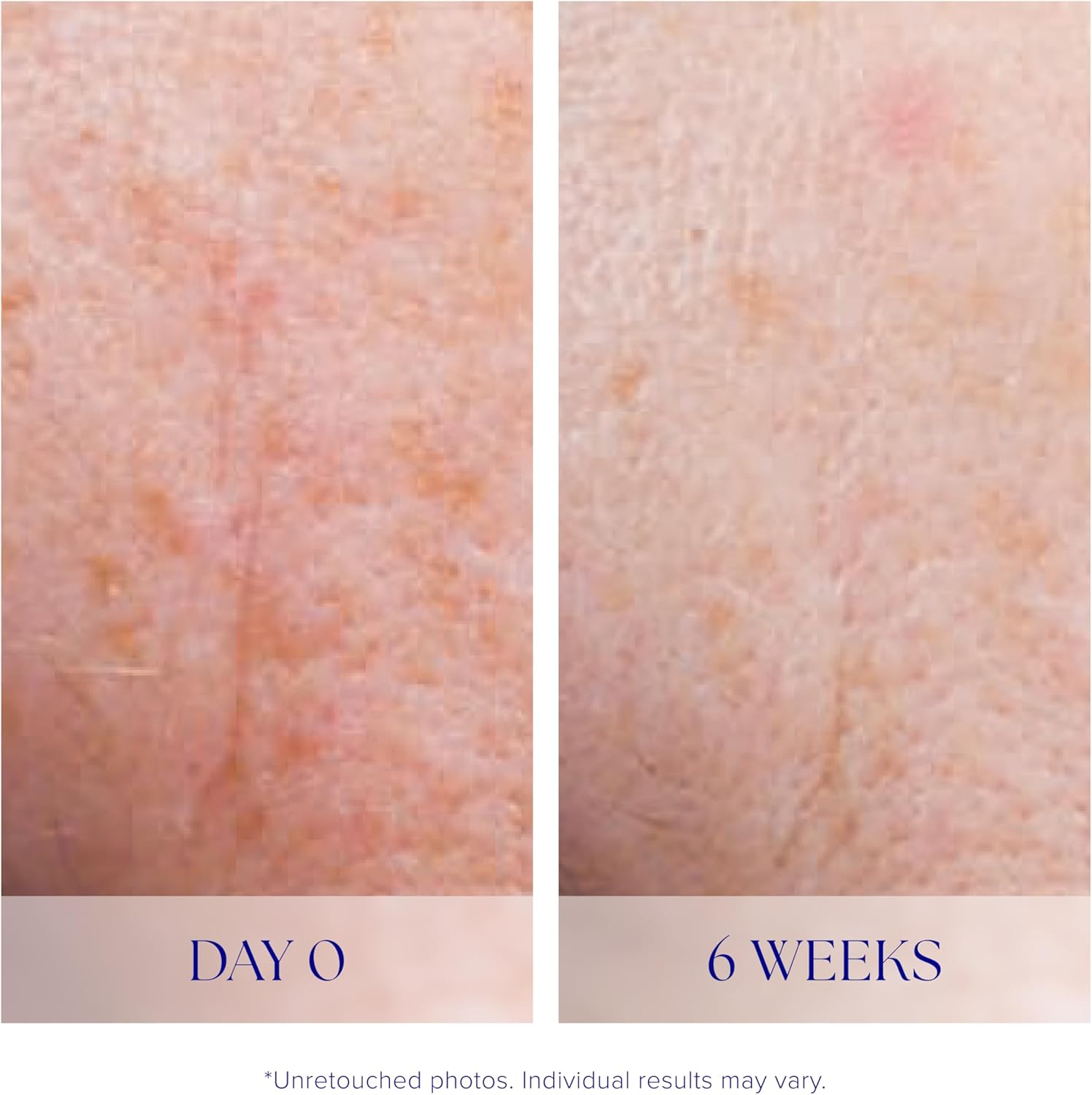 IS Clinical Active Serum 15Ml