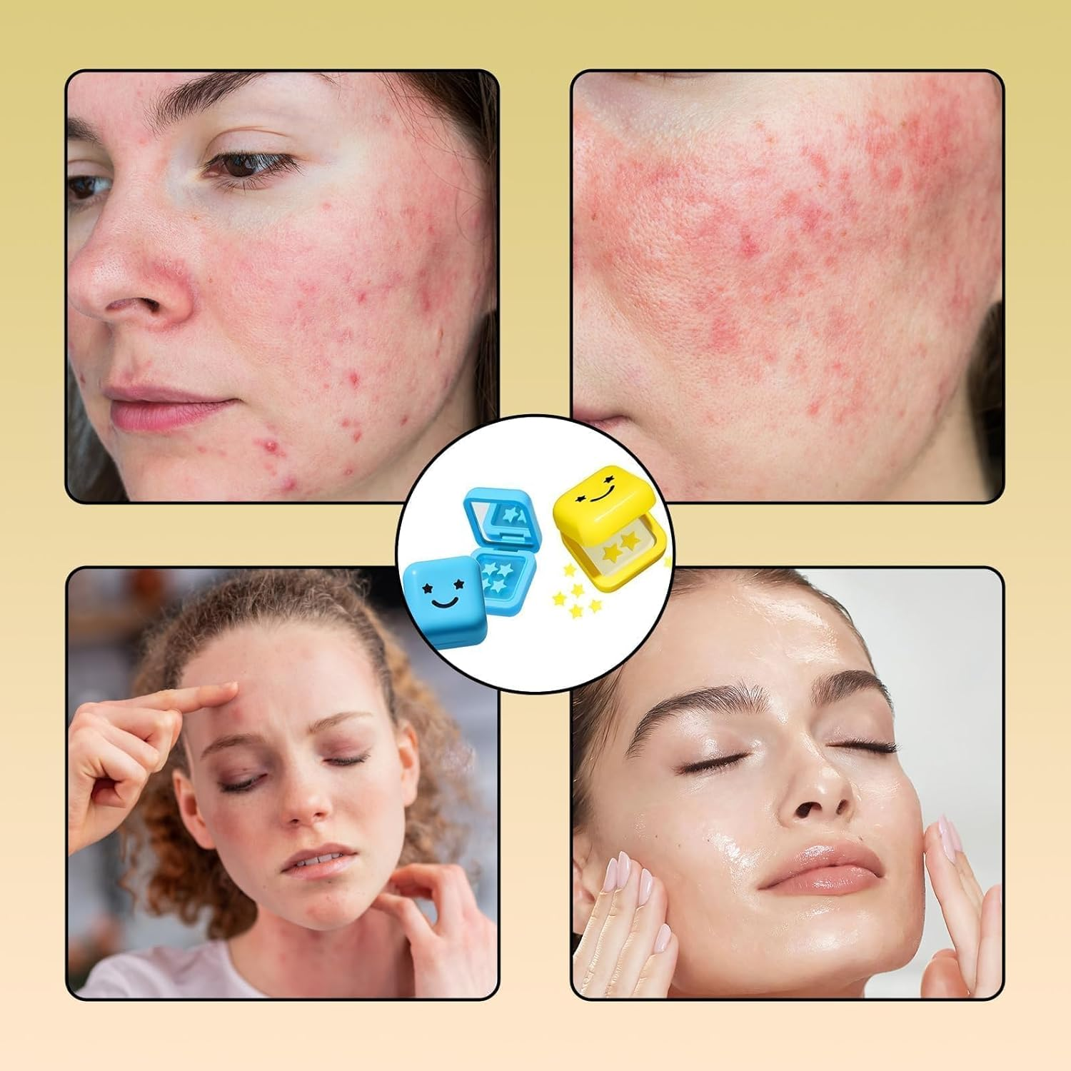 64Pcs Pimple Patches Stars, Star Pimple Patches, Star Spot Patches and Reduce Redness for Face and Skin image number 6