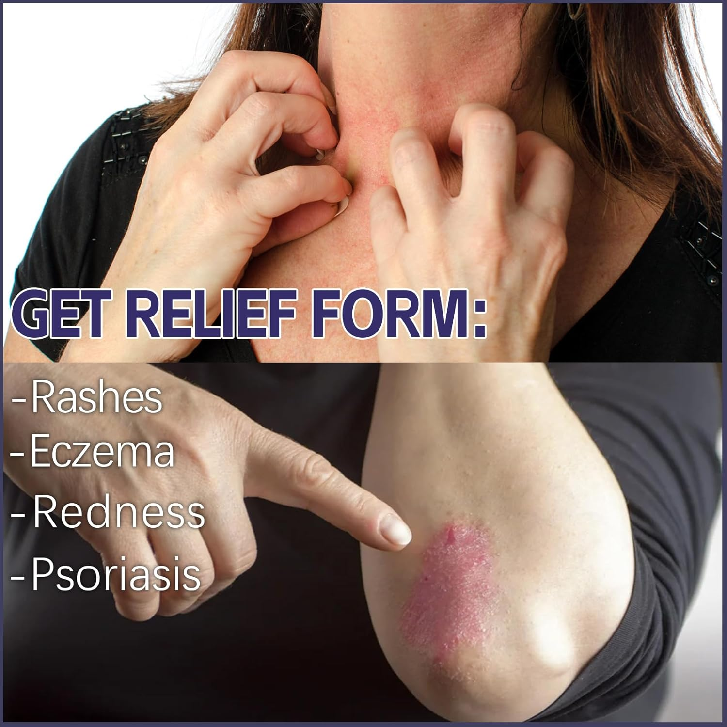 Psoriasis Creams Dermatitis Cream,Eczema,Soothes Red & Inflamed Skin,Moisturizing Body Cream,Lotion image number 4