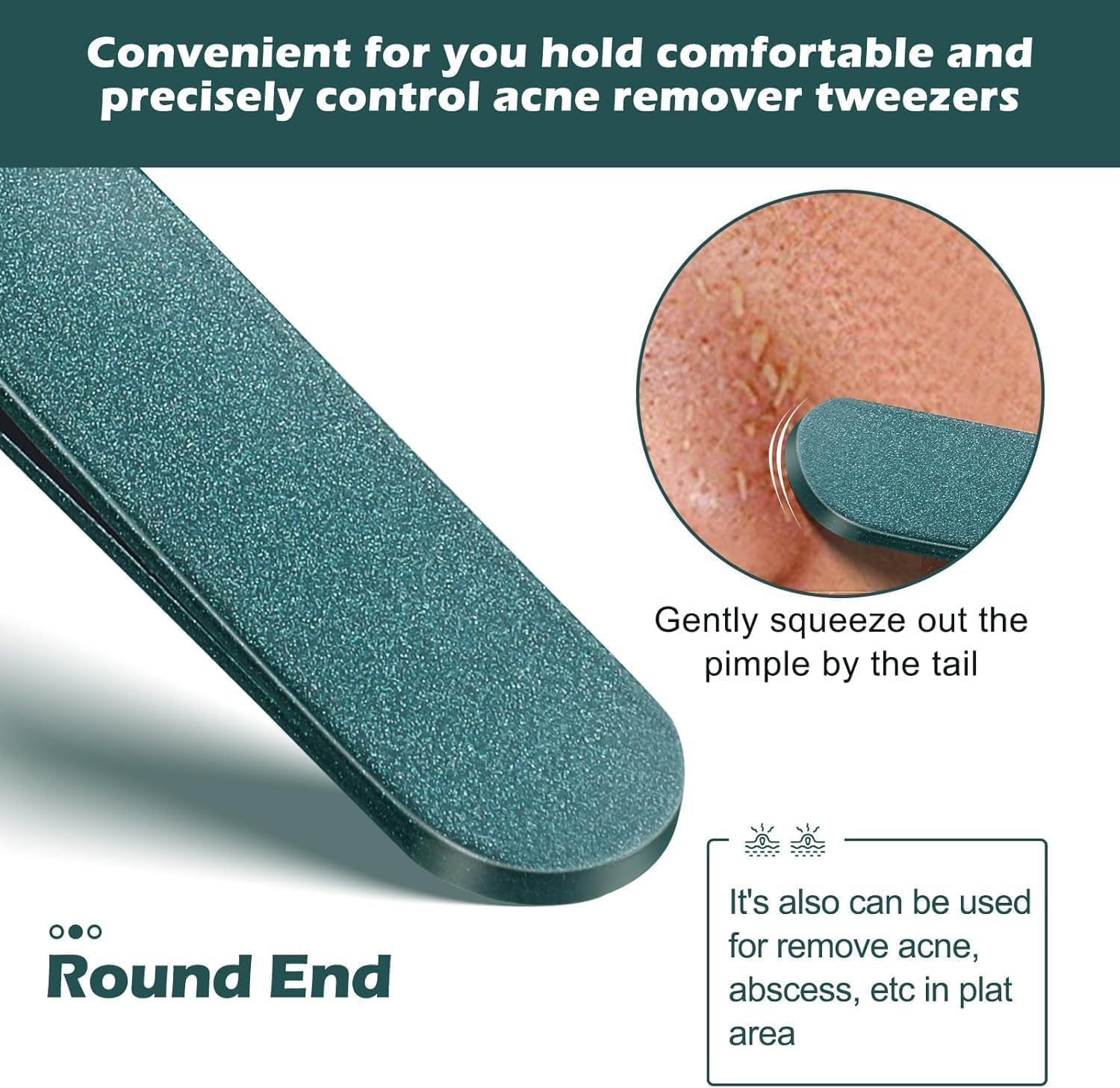 Upgrade Facial Blackhead Remover Tweezers, Ingrown Hair Tweezers,Extractor Acne Removal, Pimple Popper Tool Suit with Box (Green, 3Pieces/1Set) image number 3