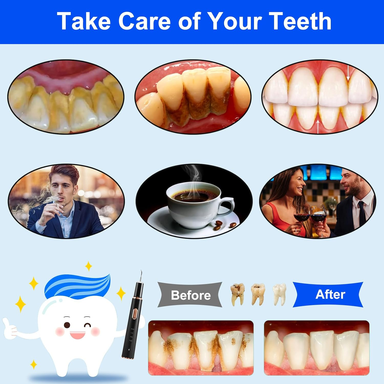 Plaque Remover for Teeth - Tartar Remover for Teeth 3 Modes and 4 Replaceable Heads, Plaque Remover Rechargeable with Mirror