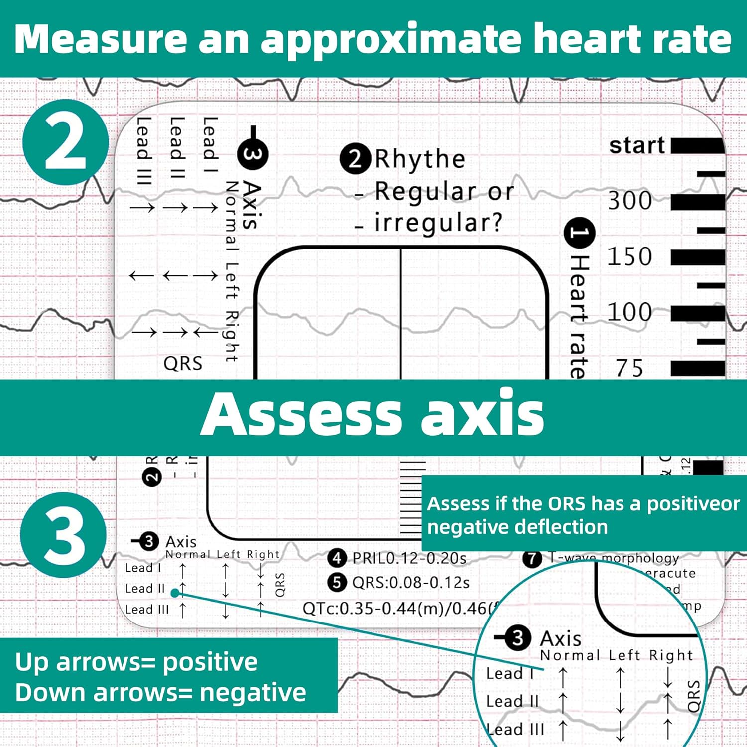 2 Pack Ecg-7-Step-Ruler - ECG/EKG Interpretation Tool, Portable Pocket Ruler, ECG Reference Guide, EKG Ruler Horizontal Badge Card Tool for Accurate Heart Rate and Interval Assessment image number 4
