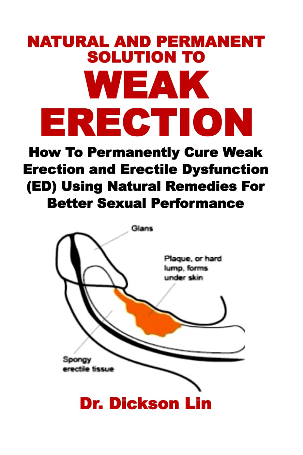 NATURAL and PERMANENT SOLUTION to WEAK ERECTION: How to Permanently Cure Weak Erection and Erectile Dysfunction (ED) Using Natural Remedies for Better Sexual Performance