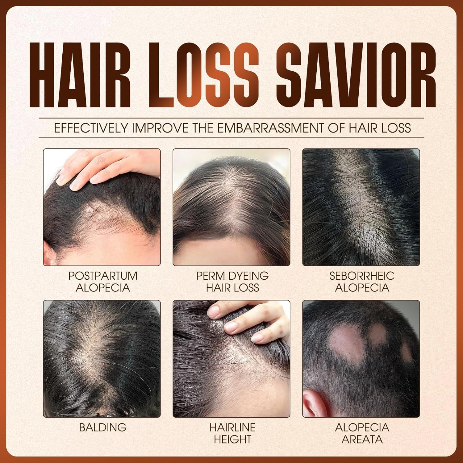 Herbs Boat Hair Growth Spray, Hair Growth Spray, with Biotin, Ginger Root Extract, He Shou Wu, Castor Oil, Reduced Shedding, Hydration and Silky Texture for Women & Men - 50Ml (1Pcs) image number 5