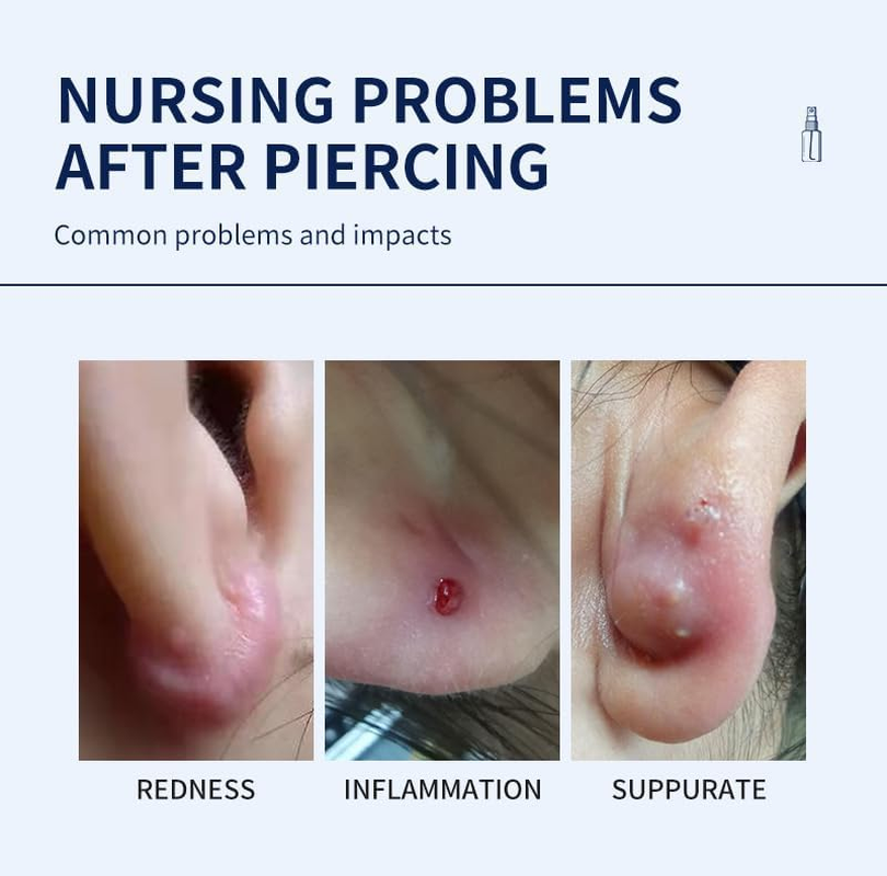 Piercing Aftercare Spray and Keloid Bump Removal &ndash; Sea Salt Spray for Body and Facial Piercings &ndash; Ear, Nose, Navel, Oral & Body Piercing Cleaner, Aftercare Solution for New Piercings image number 4
