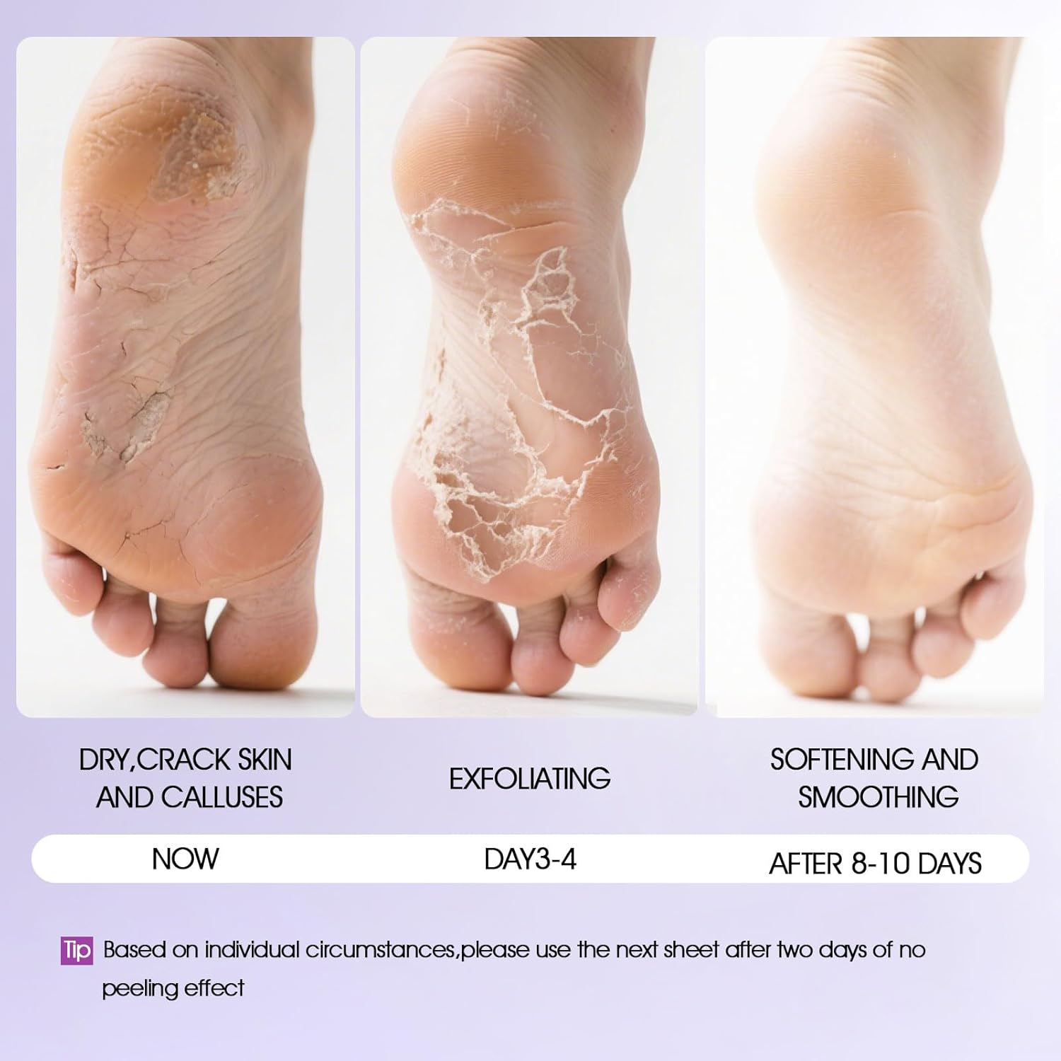 Foot Peeling Mask for Dry & Cracked Skin - Exfoliating Foot Mask to Remove Dead Skin & Calluses, Baby Soft Feet for Men & Women - Foot Spa (2Pcs, Lavender) image number 6