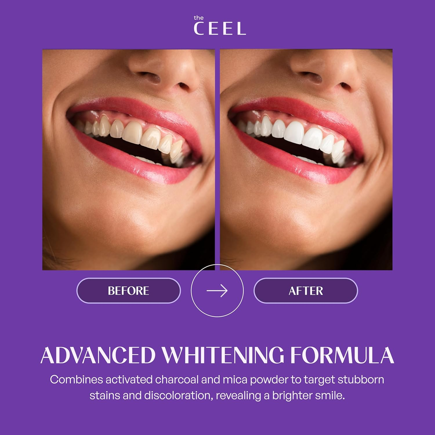 Purple Toothpaste for Teeth Whitening with Activated Carbon & Mica Powder - Color Correcting Teeth, Stain & Plaque Remover Oral Care Formula with Mint Flavor - Gentle on Enamel & Gums - 75G image number 2
