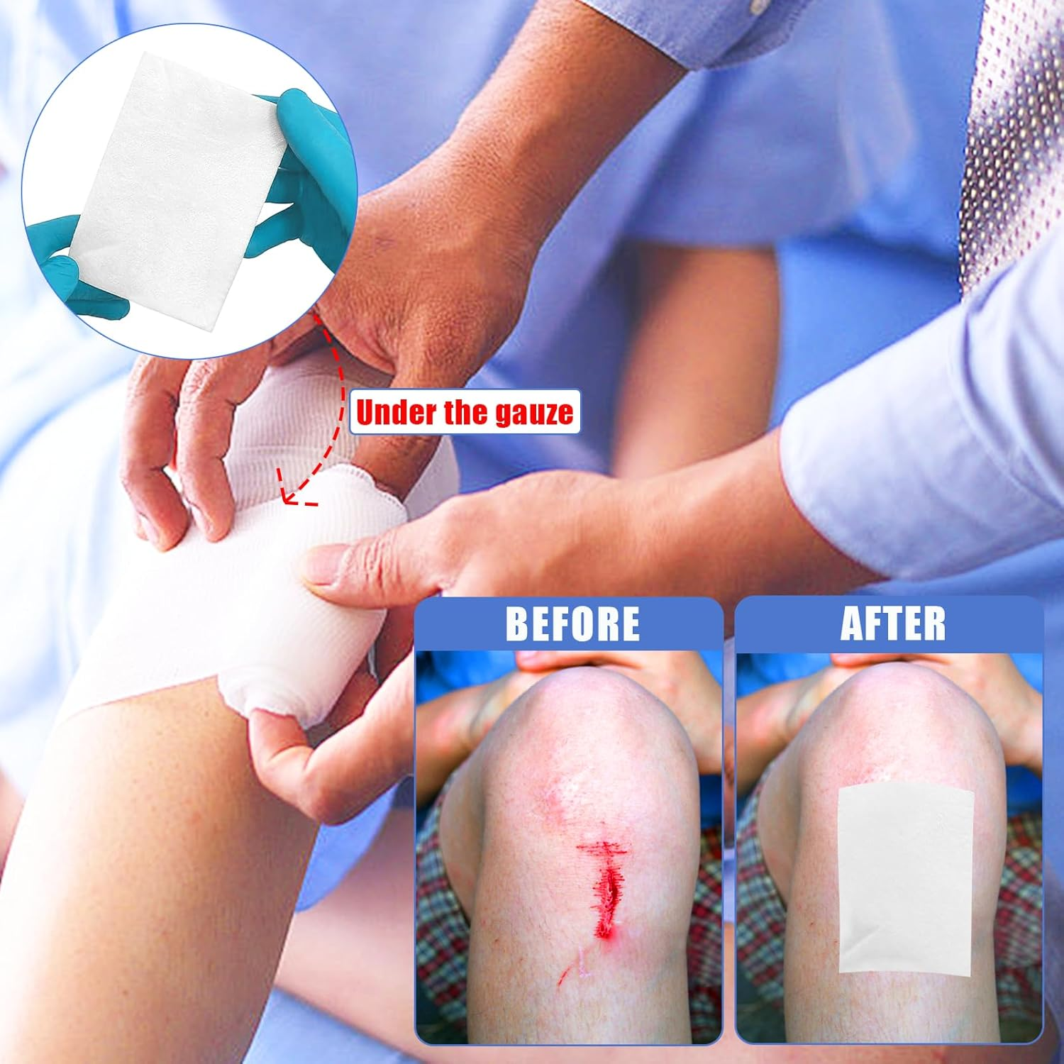 Non-Stick Wound Dressing Pads, 5 CM X 7.5 CM, Pack of 10, Sterile Highly Absorbent Wound Care Individually Wrapped Dressings image number 2