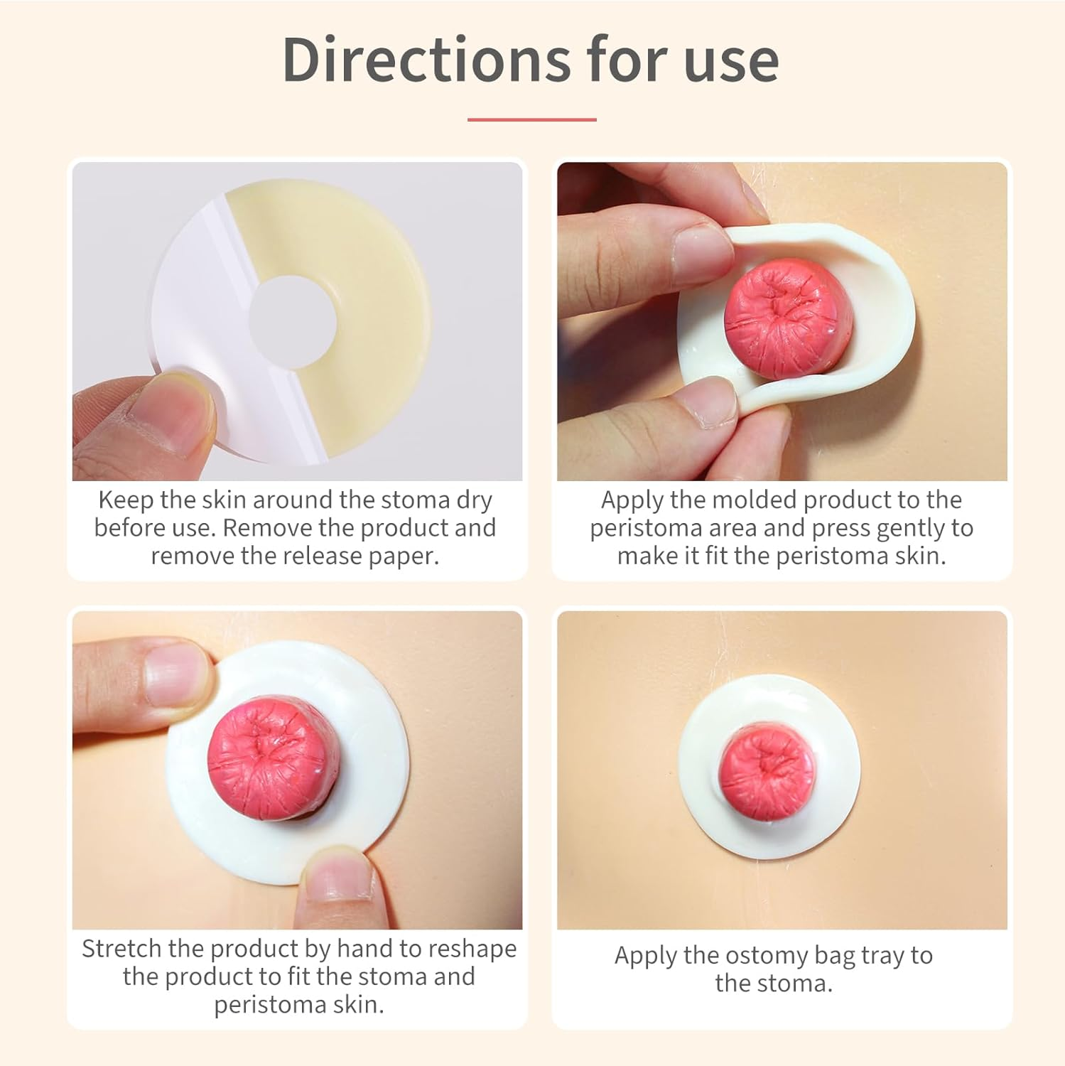 DERAYMI 10 Pack Moldable Ostomy Barrier Rings, 2Mm Thickness Sting-Free Elastic Ostomy Rings Hydrocolloid Ileostomy Barrier Rings Secure Seal for Colostomy Bags image number 1