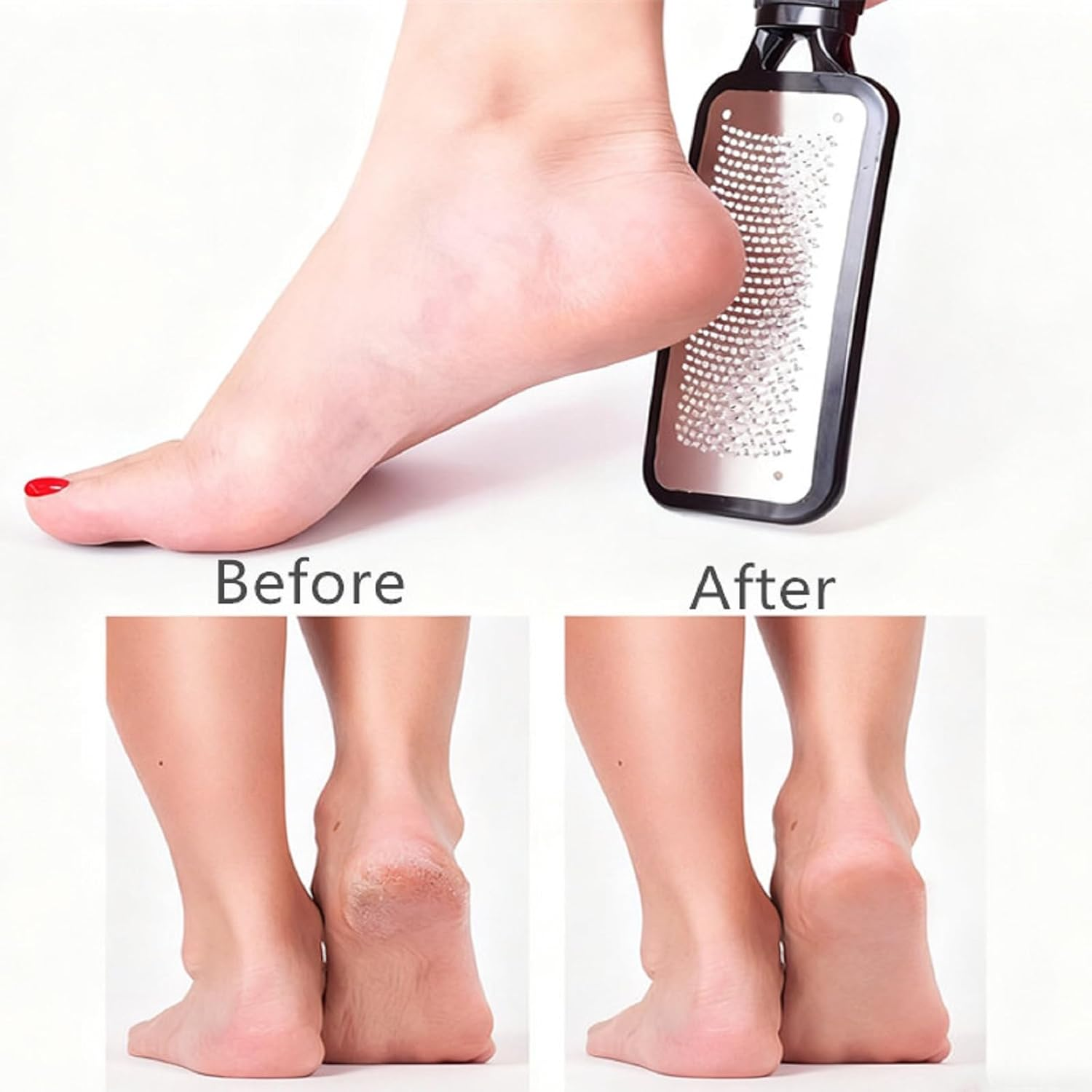 Sularpek Foot Rasp Callus Remover, High-Grade Stainless Steel Foot File for Wet & Dry Use Pedicure Tool to Remove Hard Skin and Calluses (Black 1 Pack) image number 1