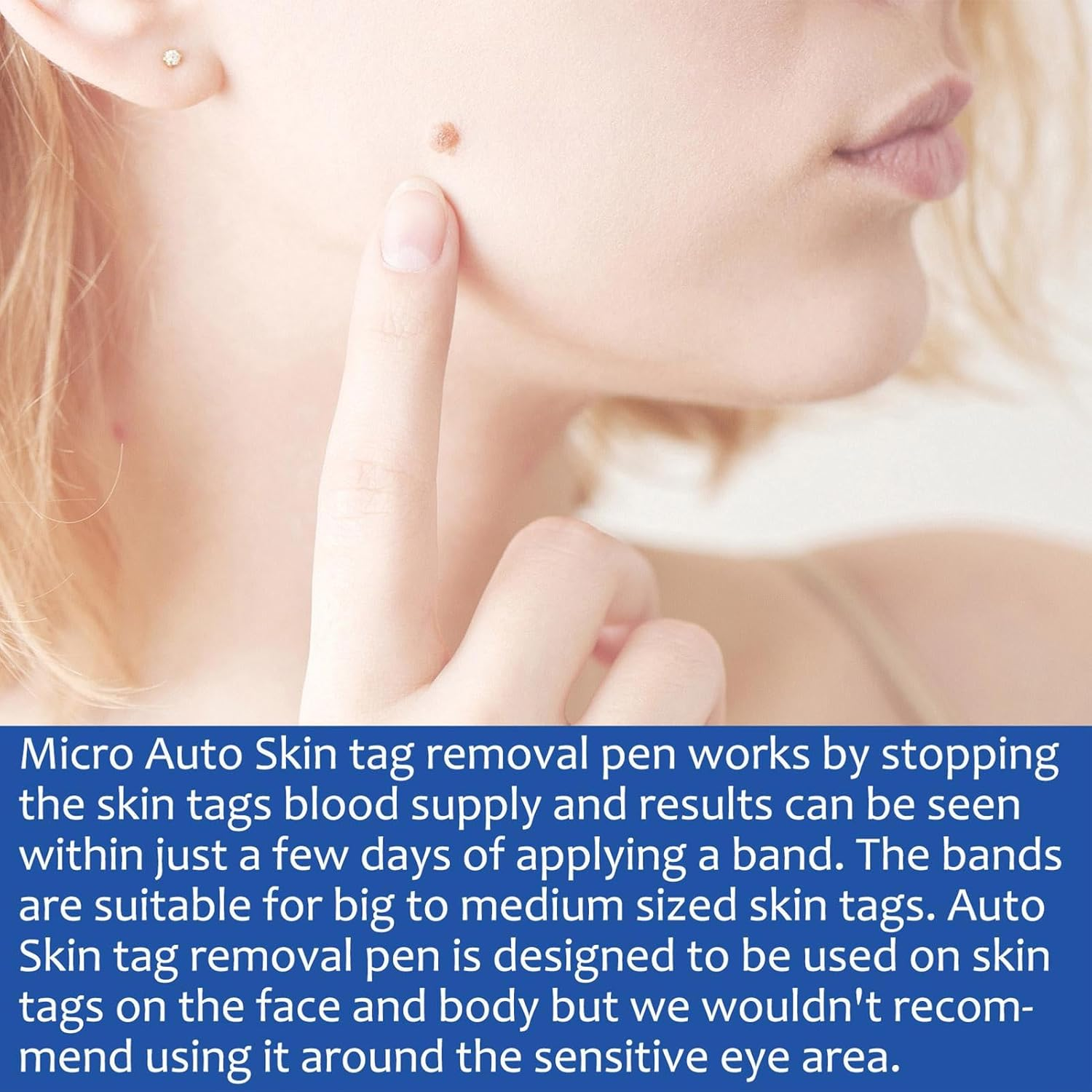 Skin Tag Remover Tools, Wart Remover Pen, Skin Tags Device for Small/Large Tags(4-9Mm), with Removes Cone-Shaped, Cleansing Pads, Patches, Instruction Manual