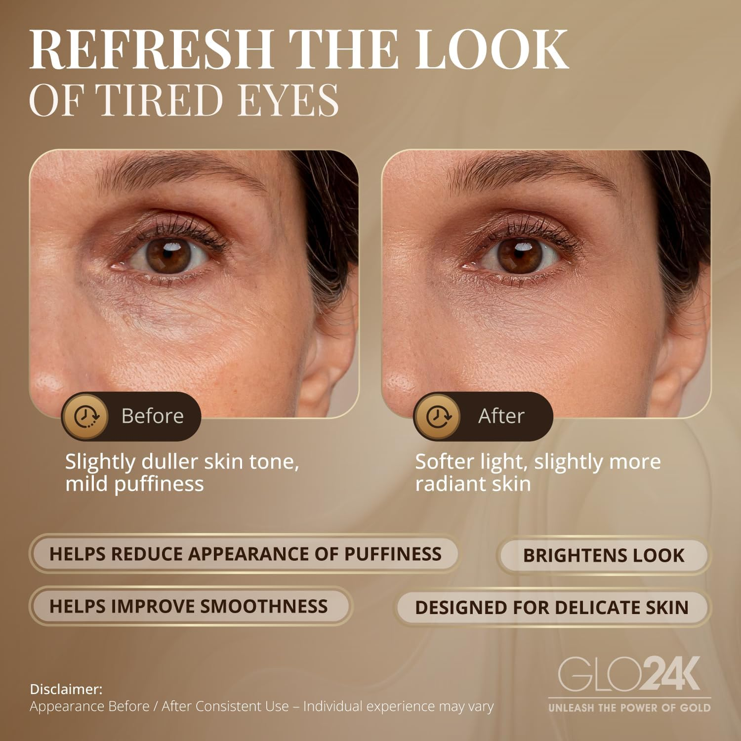 GLO24K Eye Care Beauty Massager. for Radiant, Beautiful Skin around the Eyes. image number 1