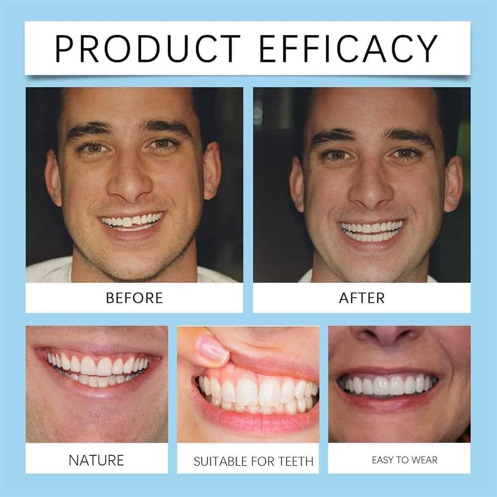 Denture Silicone Reline Kit,Thermoplastic Denture Adhesive,Soft & Comfortable Reliner,Cushion Denture Reliner for Men Women - 1Pcs image number 3