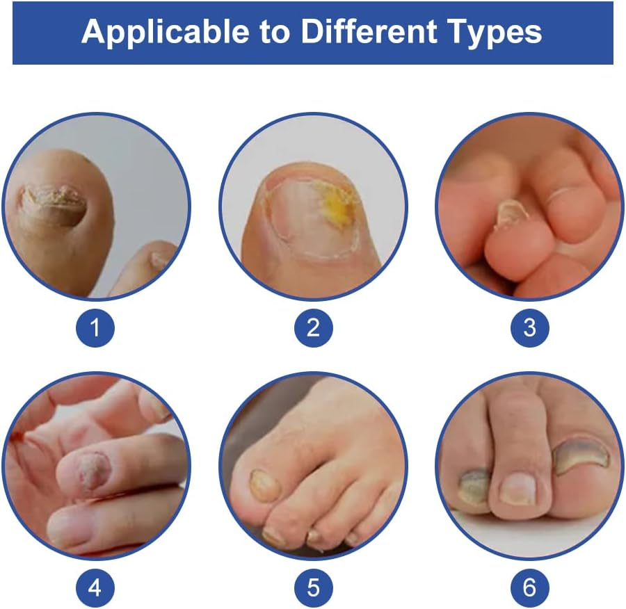 Nail Care and Treatment, Nail Repair, Nail Care for Healthy Foot and Hand, Nail Oil, Nail Care Oil, Nail Care Nourishing, Nail Essence Serum, for Broken and Discoloured Nails image number 3