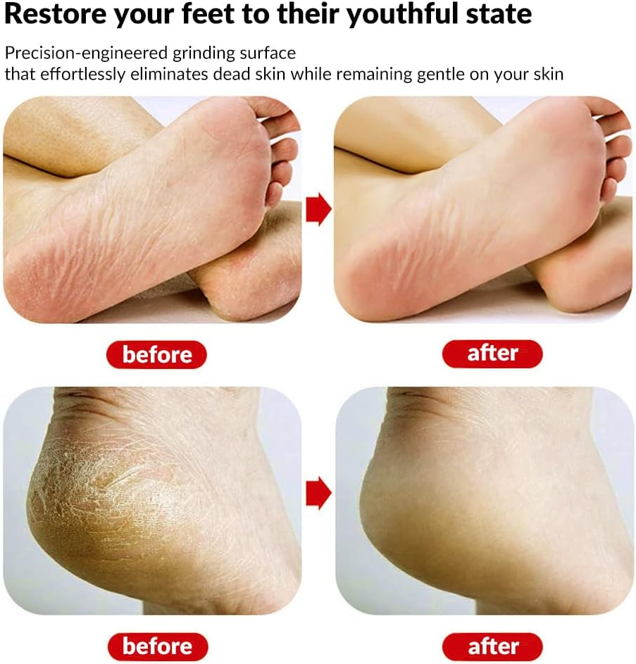 Holyzuel Glass Foot File, Foot Callus Remover with Glass Etching Technology, Portable Handheld Sized Foot Scraper for Cracked Heel for Wet and Dry Feet - Shinning Blue image number 2