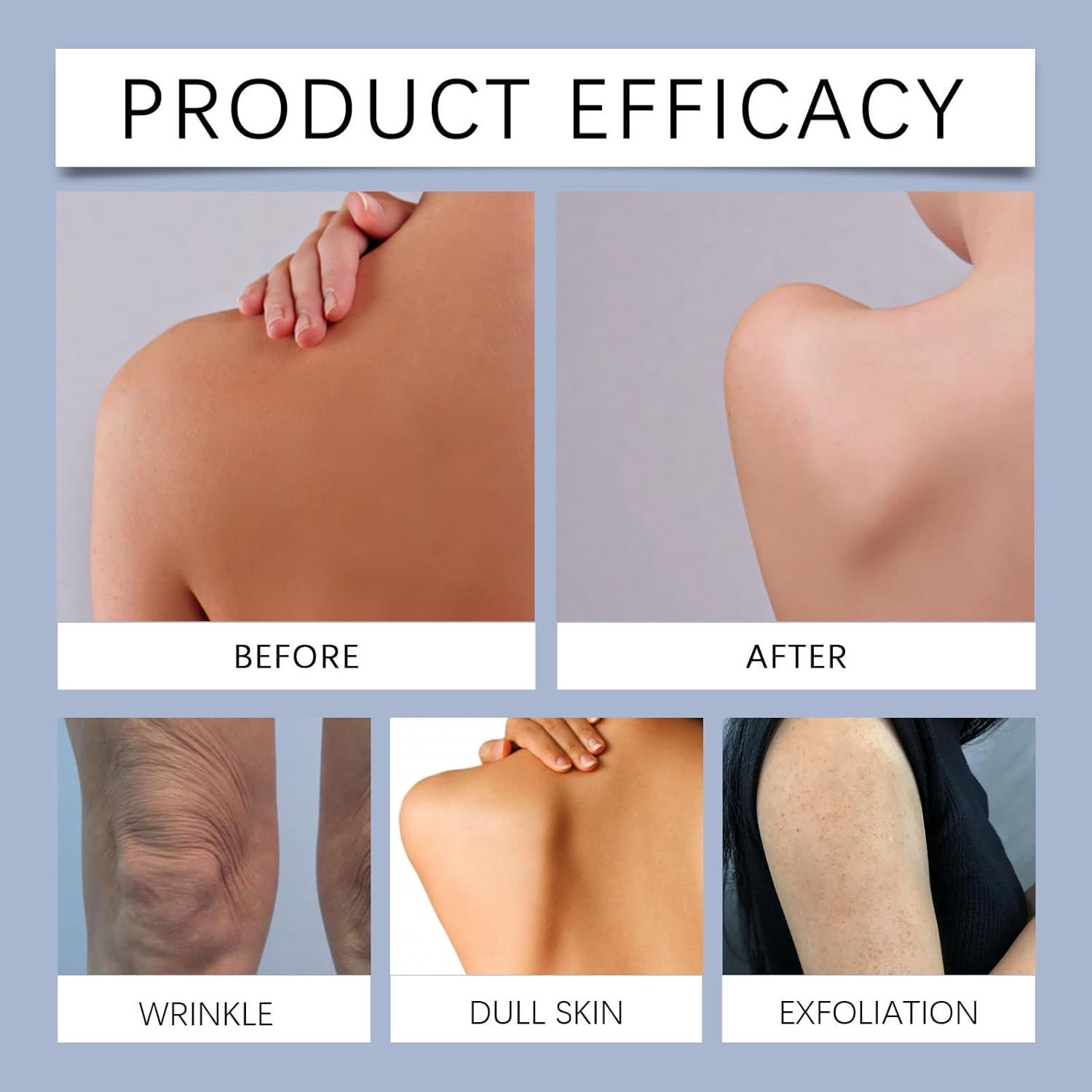 Underarm Whitening Cream, Dark Spot Remover for Face & Body, Skin Lightening Cream for Sensitive Areas, Armpits, Knees, Elbows, Areas, Even Skin Tone image number 4