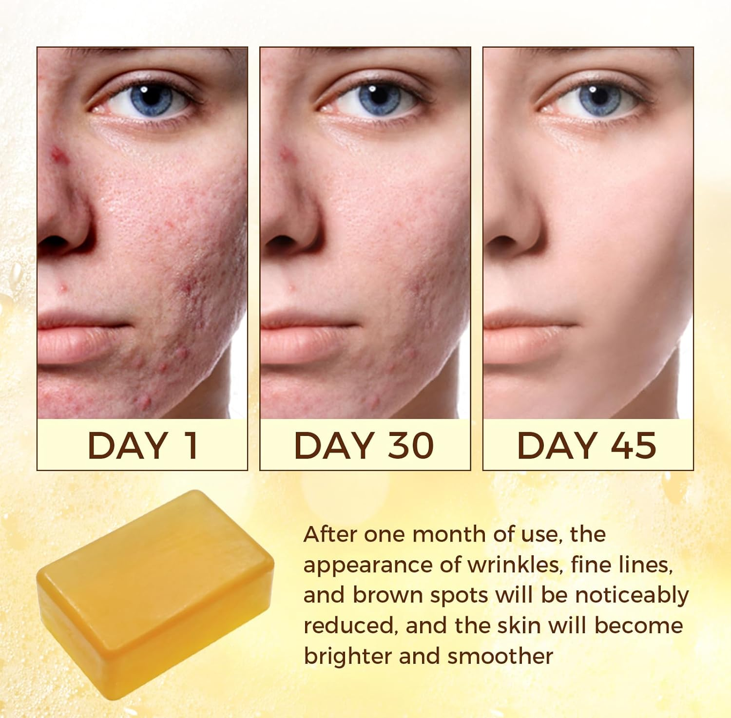 Dark Spot Remover Soap Bars,Turmeric Soap Bar,For Body & Face with Vitamin C, E, Retinol, Collagen,Shea Butter,Infused with Hyaluronic Acid, 2 Pack,Natural Soap for Men,Women image number 1