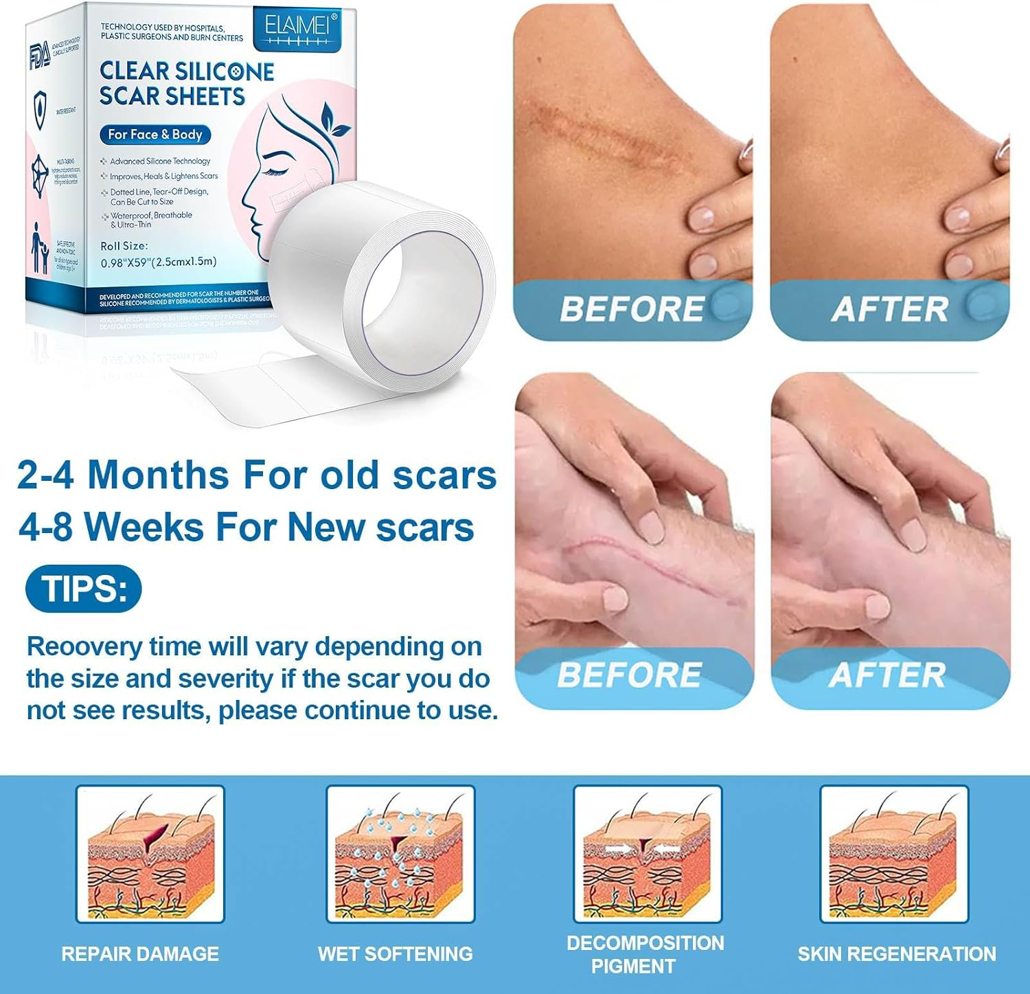 Silicone Scar Sheets, Professional Scar Tape(2.5 X 150Cm Roll-1.5M), Reusable Scar Removal Sheets, Soft Easy-Tear Silicone Scar Tape for for C-Section, Surgery, Burn, Keloid, Acne Etc. image number 1