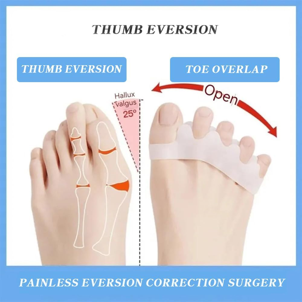 QISANKEE Silicone Toe Spacers, Toe Separators for Correct Toes Alignment, Soft Gel Toe Spacers to Correct Bunions and Restore Toes to Their Original Shape, Hammer Toe Straightener for Plantar Fasciitis for Women & Men image number 4