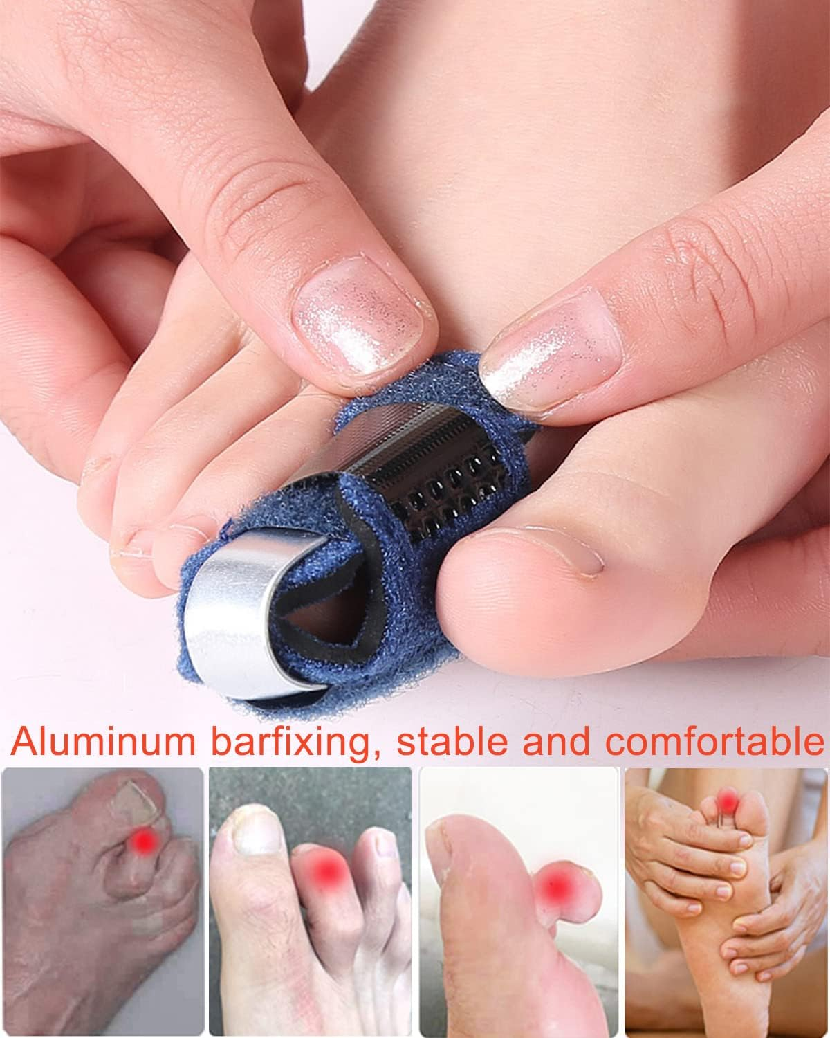 Toe Splint Toe Stabilizer Support Splint Adult and Child Toe Finger Fixation Velcro Aluminum Strip Supports Hammer Shaped Toes for Broken Toes Straightening Arthritis Joint Immobilization
