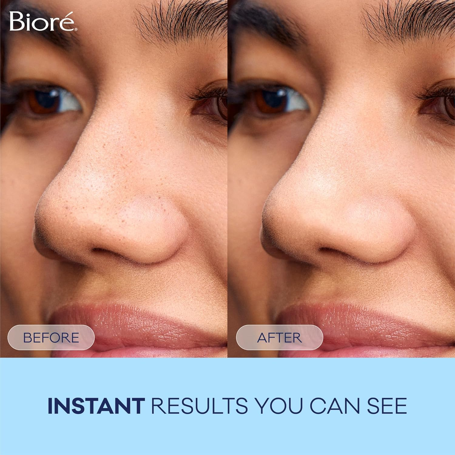 Bior&eacute; Original Blackhead Remover Strips, Deep Cleansing Nose Strips with Instant Pore Unclogging, Features C-Bond Technology, Oil-Free, Non-Comedogenic Use, 14 Count image number 5