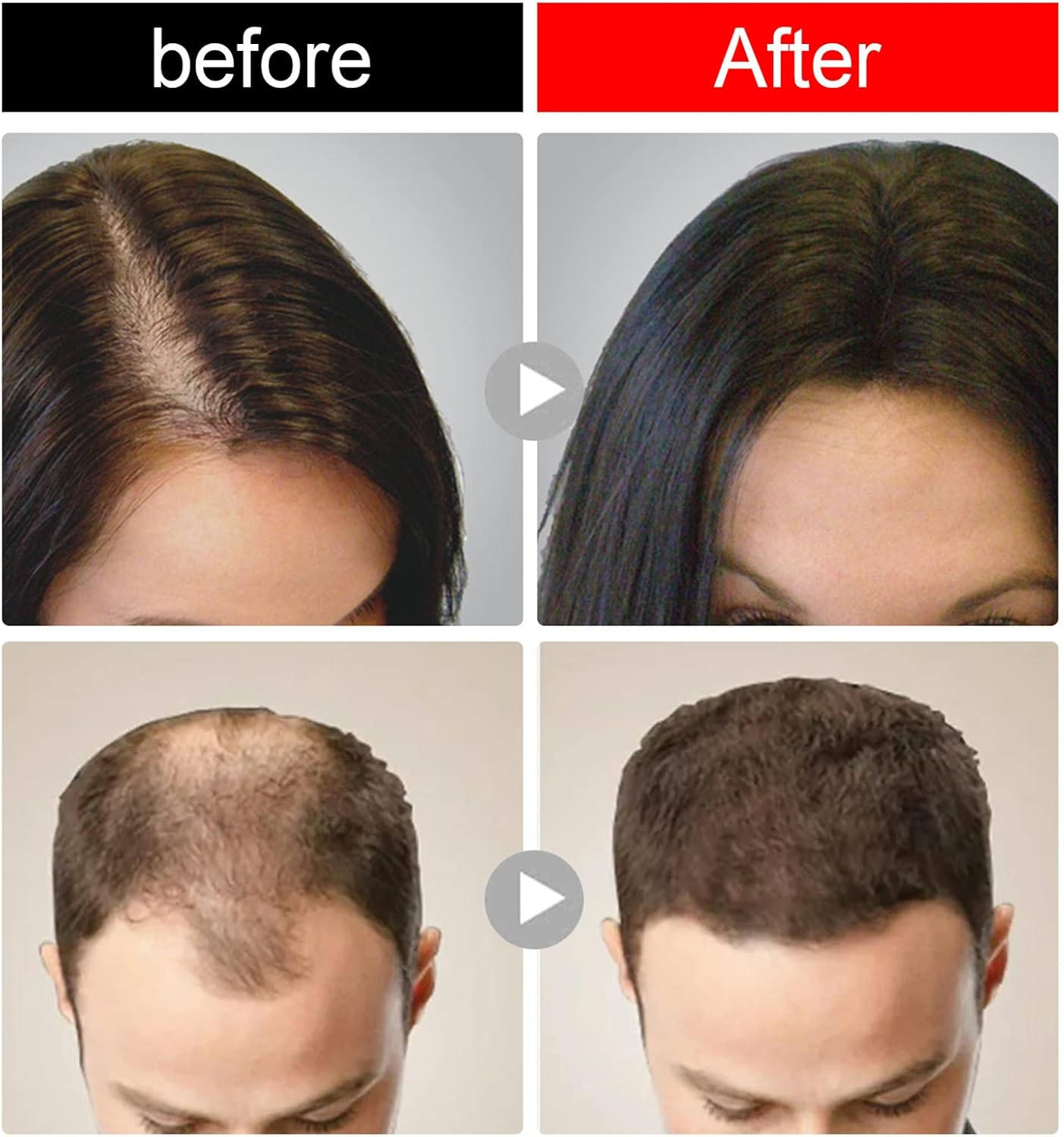 1Pc Hair Growth Rice Soap Shampoo Bar Nourish Hair Root Balance Oily Scalp Increase Hair Volume