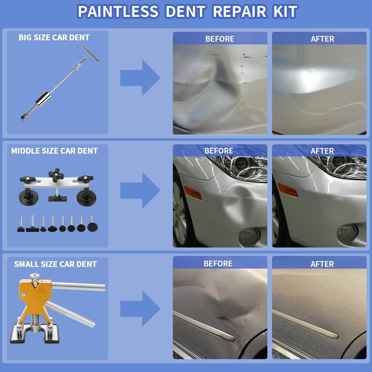 ROADGIVE 97PCS Auto Body Dent Repair Tool Kit, Paint-Friendly Dent Repair Kit with Golden Lifter, Slide Hammer T-Bar Dent Puller, Bridge Puller, Suction Cup and Glue Gun for Car Dent Remove Tools Kit image number 6