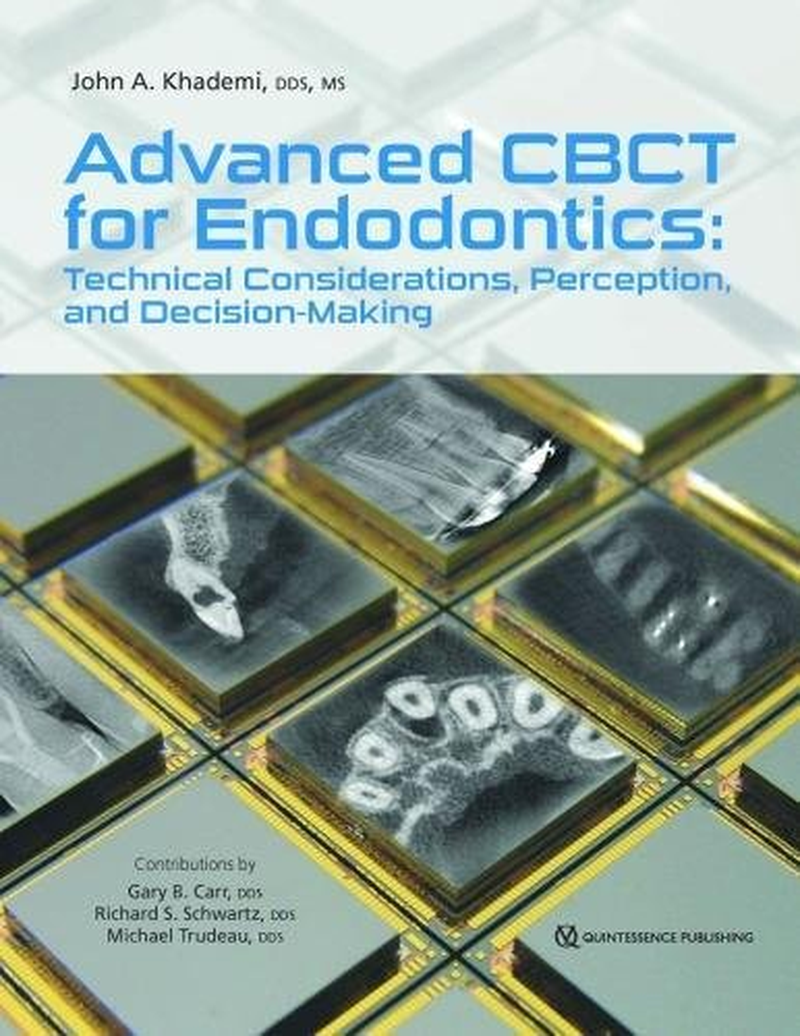 Advanced CBCT for Endodontics: Technical Considerations, Perception, and Decision-Making