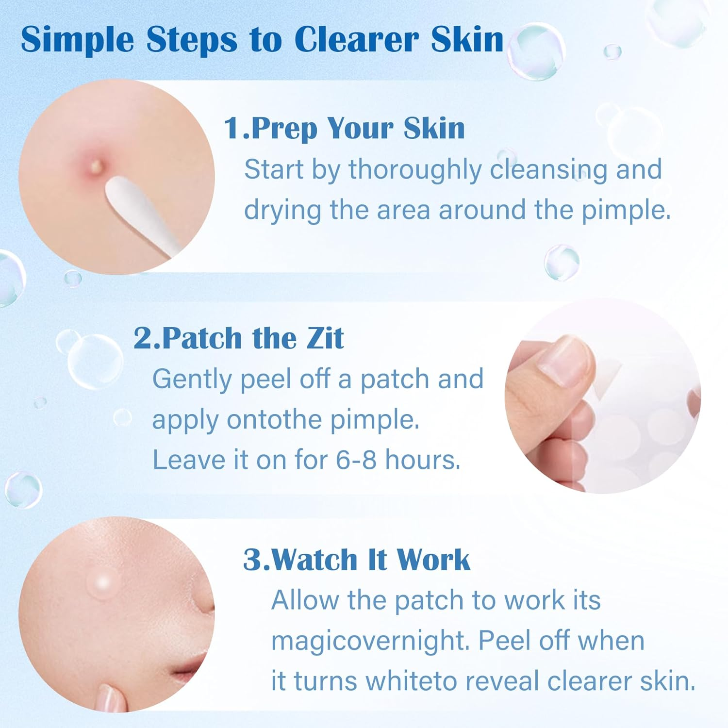 EKIND 180PCS Pimple Patches, Hydrocolloid Acne Patches for Face, Invisible Spot Cover for Blemishes & Breakouts, 2 Size Zit Patches image number 3