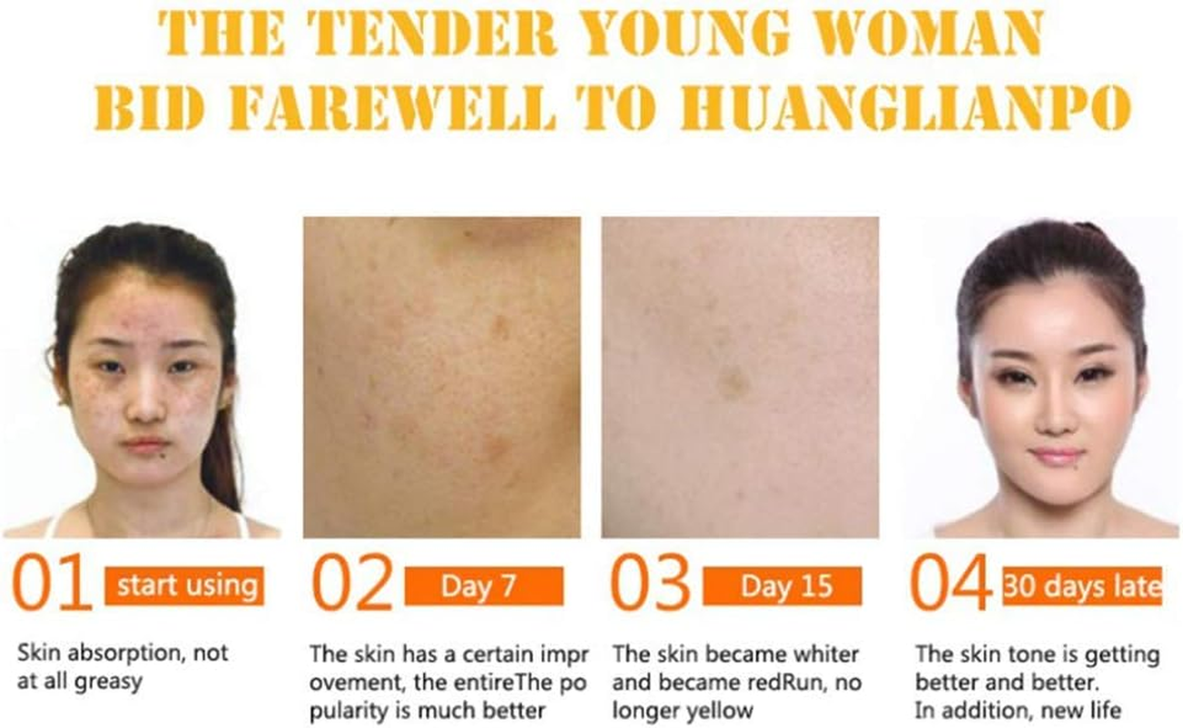 Ultra Brightening Spotless Oil Skin Care, Whitening Whitening, Hydration Helps the Blemishes Scaring Stretch Marks to Fade Skin Sores, Dark Spots Age Spots Hyper Pigmentation image number 6