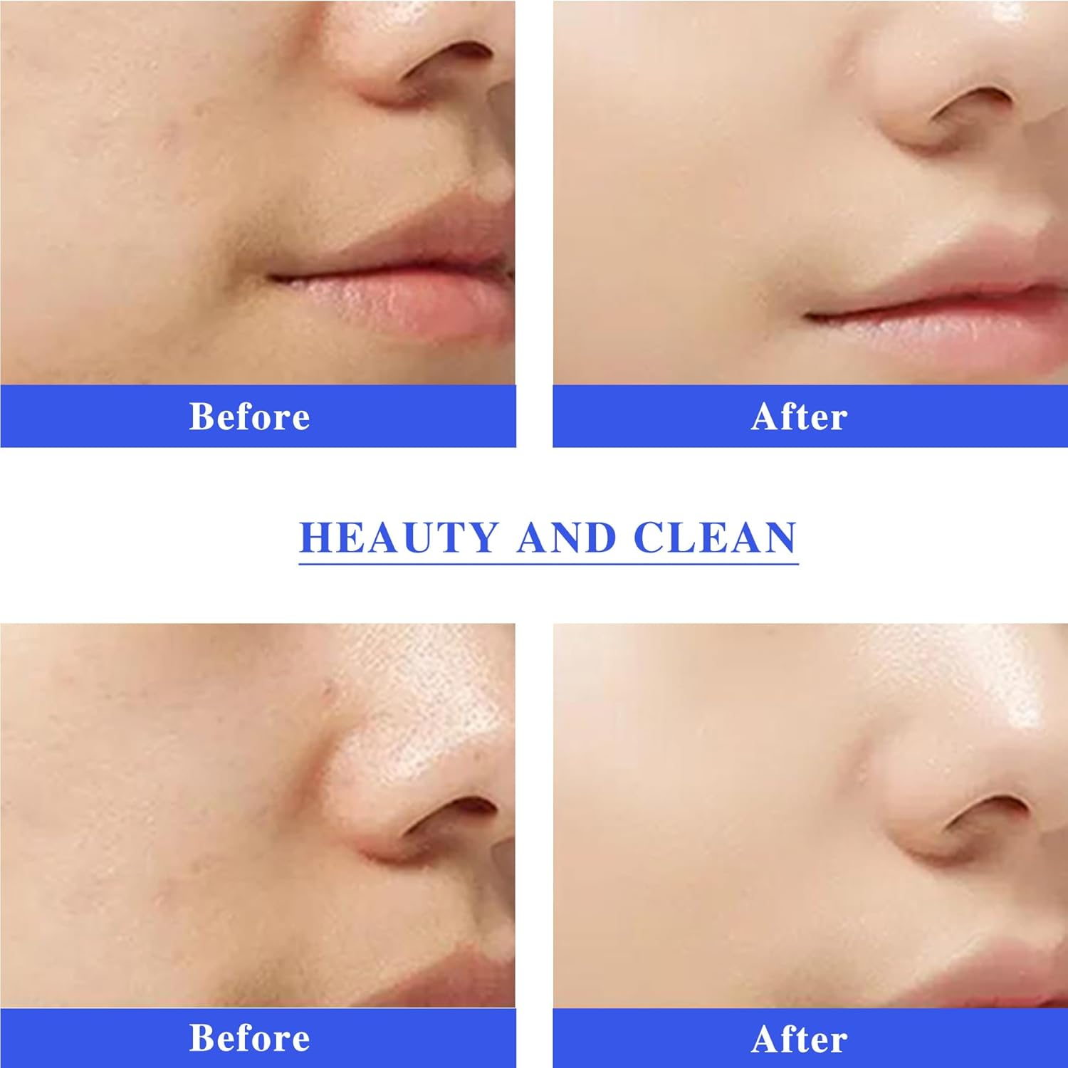 AS1 SA2 AO3 Aqua Peeling Solution for SPA Salon, Small Bubble Aqua Peeling Solution Serums for Facial Cleansing, Facial Machine Solution for Cleaning Face(400Ml X 3 Bottles) image number 6