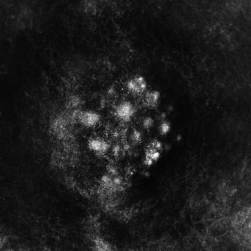 Synecdoche Synecdoche