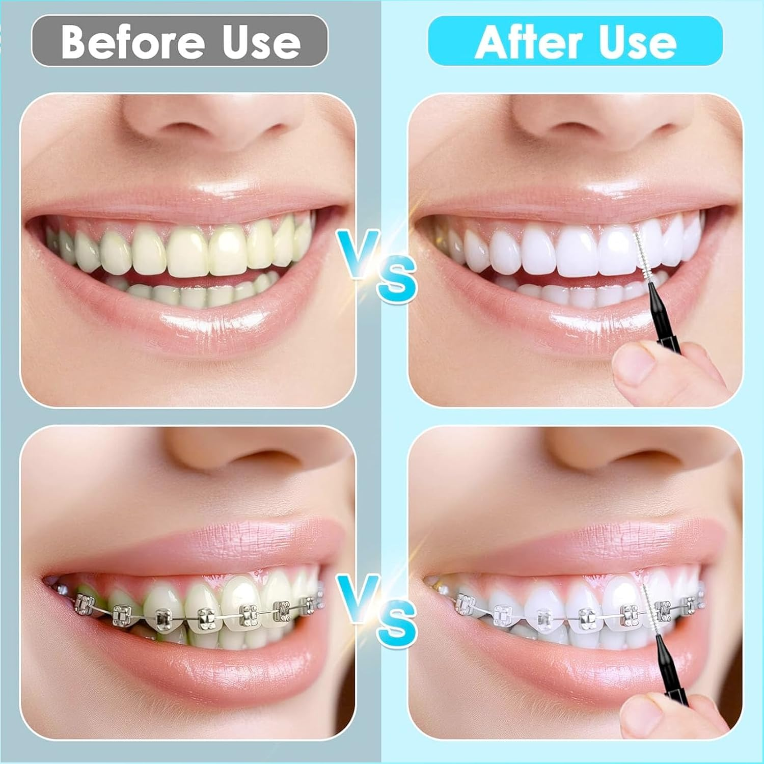 300PCS Interdental Brushes for Braces, Soft and Bendable Dental Brush for Orthodontic Braces, Braces Cleaner Brush Tooth Pick Teeth Flossers Brushes for Teeth (Black and Blue) image number 4