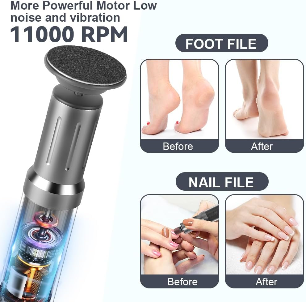 AOOWU Electric Callus Remover, 6 Adjustable Speed Pedicure, 2 in 1 Electric Foot Callus Remover with Foot Files and Nail Polisher, for Cracked Heels, Callus, Dead image number 5