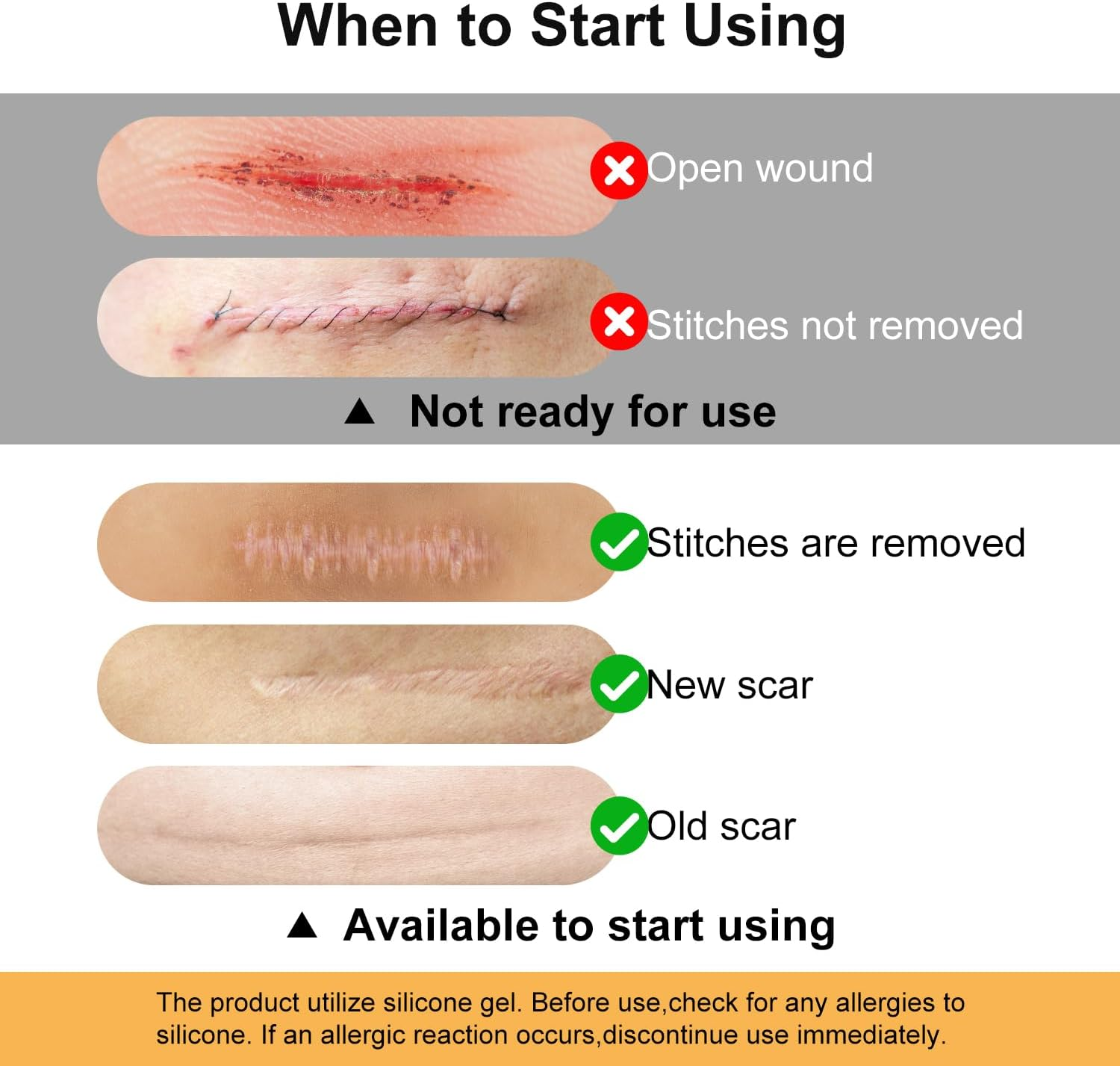 VICHYIE Silicone Scar Tape, Great Adhesion, Skin-Friendly, Reusable, Silicone Scar Sheets for Surgical/Trauma/Keloids/Acne Scars (4 X 150Cm) image number 1