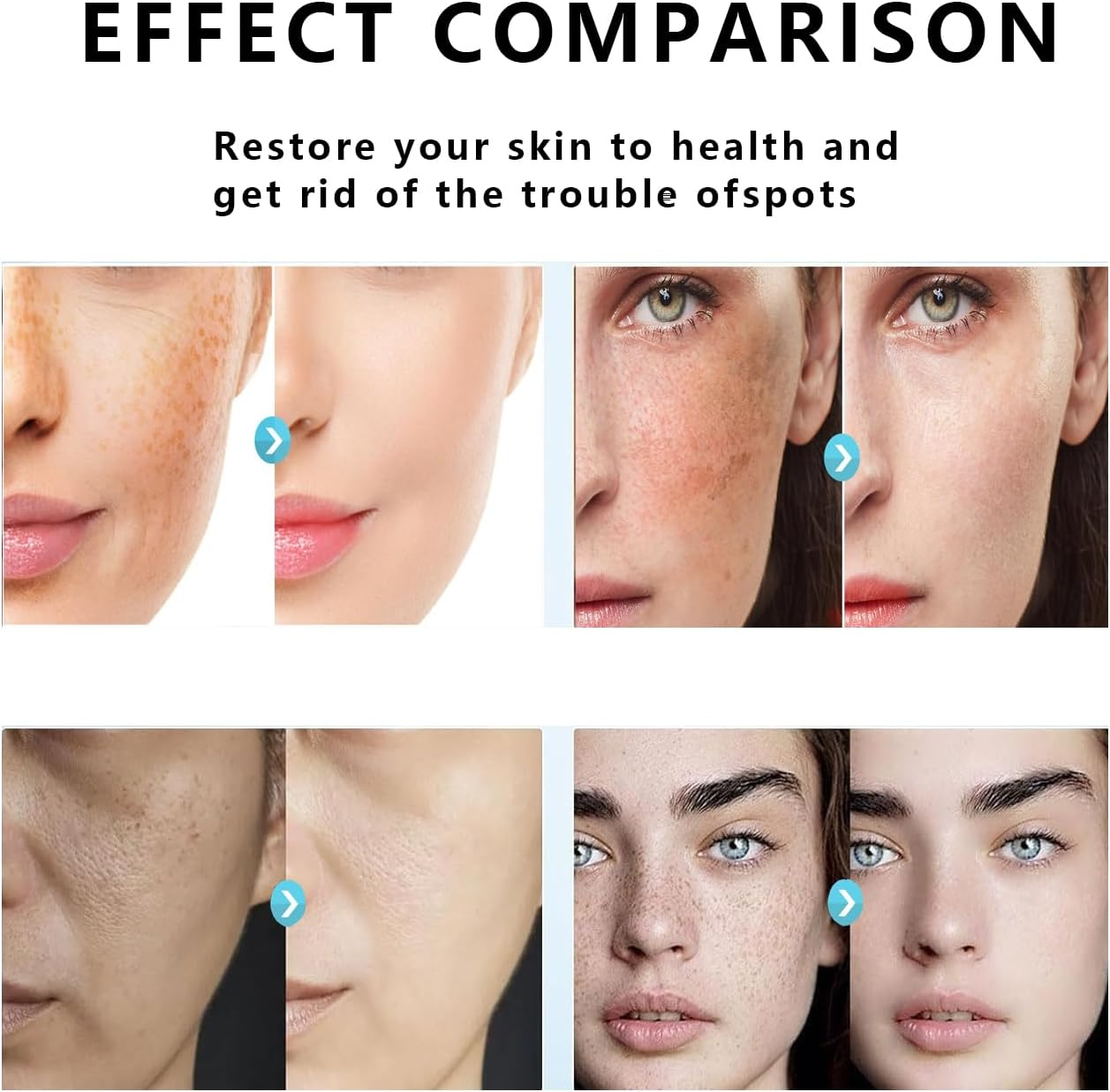 CEELGY Dark Spot Correcting Serum, Intimate Area Corrector Cream,Melasma Freckles Correcting Skin Care Face , Rapid Tone Repair ,Underarm Cream for Women for Men&Women 60G