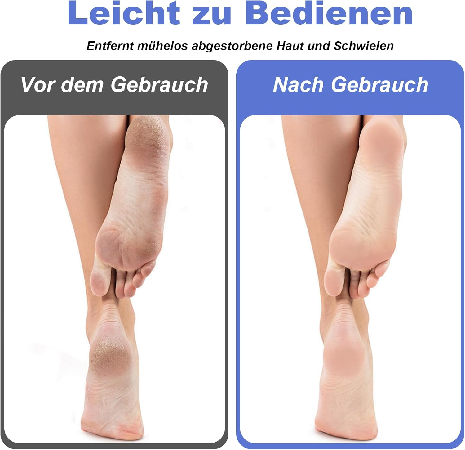 VEGCOO Pack of 4 Pumice Stone Foot Care, Double Sided Pumice Stone, Double Sided Foot Pumice Stones for Feet, Grinding Stones for Removing Dead Skin, Callus, Cuticles image number 4