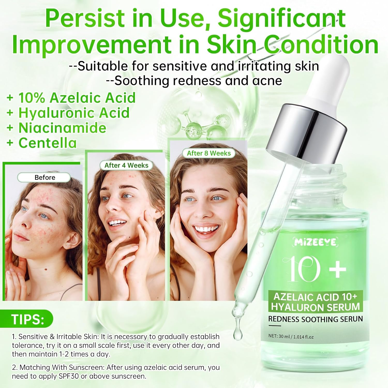 Azelaic Acid Serum for Face, Azelaic Acid 10 + Hyaluron Serum for Sensitive Skin, 30Ml Hyaluronic Acid Serum with Niacinamide for Acne & Spot Care, Redness Relief. image number 2