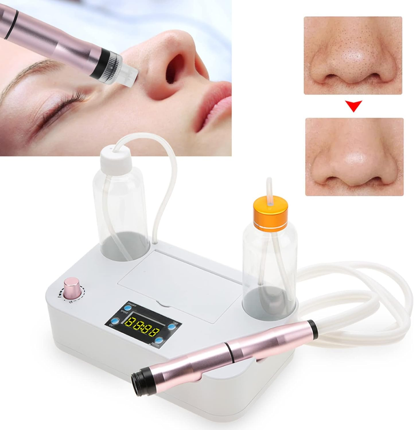 Facial Suction Machine, Facial Cleaning Machine Small Bubbles Vacuum Suction Beauty Equipment for Home & SPA Salon, Household Blackhead Remover Pore Vacuum Facial Machine (AU image number 1
