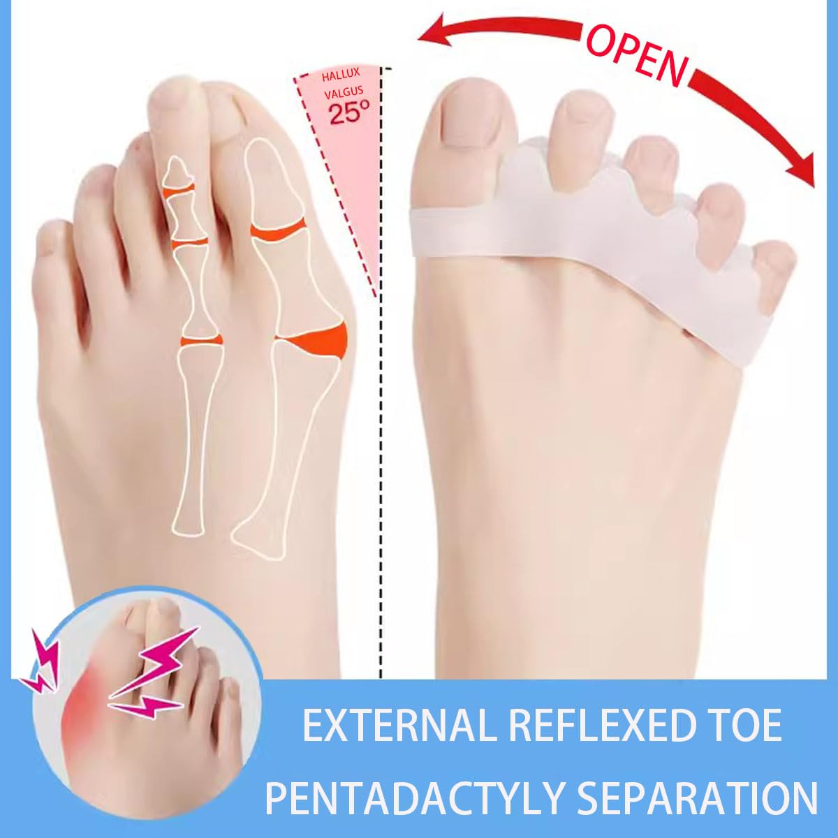 Toe Separator,6 PCS Toe Spacers for Men & Women,Correcting Bunions and Restoring Toes to Their Original Shape(Blue/Pink/White) image number 4