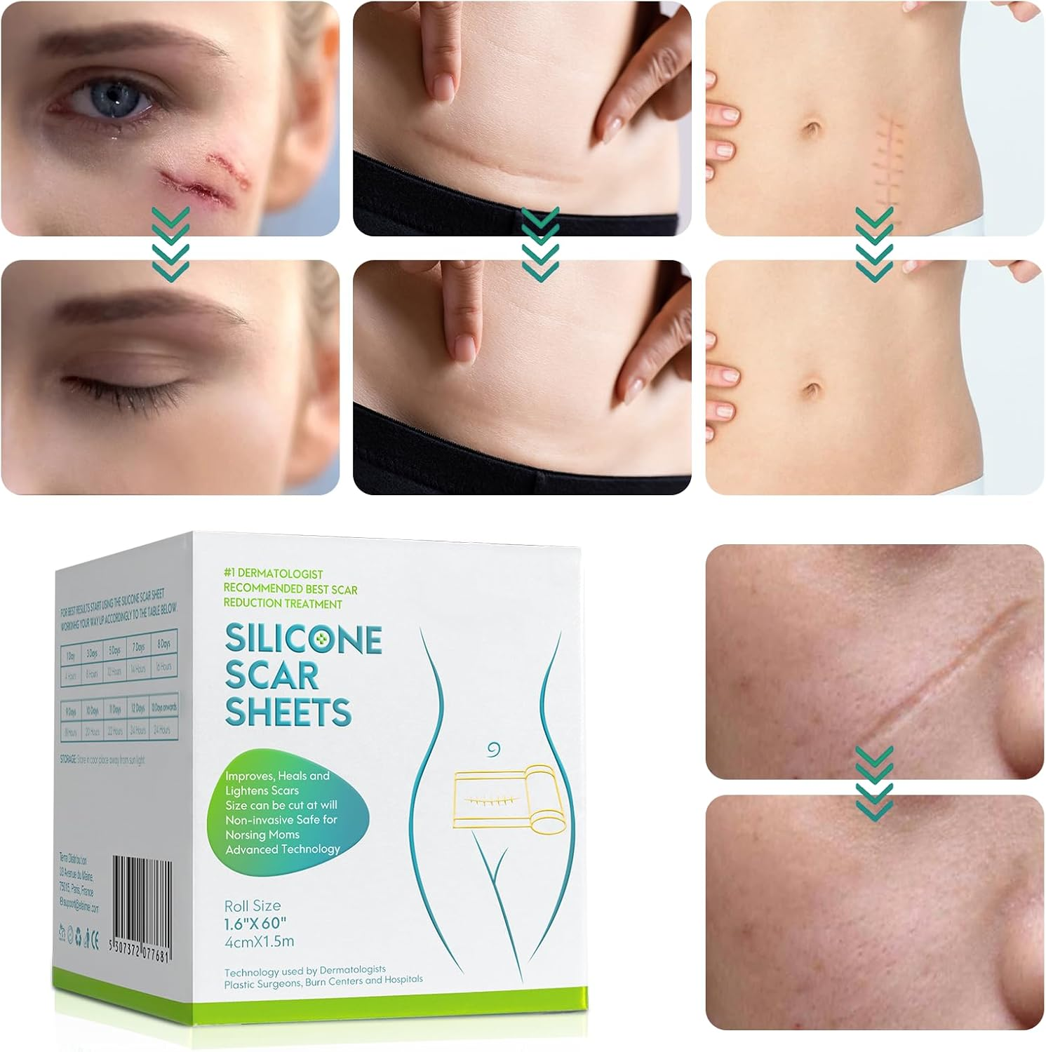 Silicone Scar Sheets(1.6&rdquo; X 60&rdquo;Roll-1.5M), Silicone Scar Tape Roll, Reusable Scar Silicone Strips, Professional Scar Removal Sheets for C-Section, Surgery, Burn, Keloid, Acne image number 2